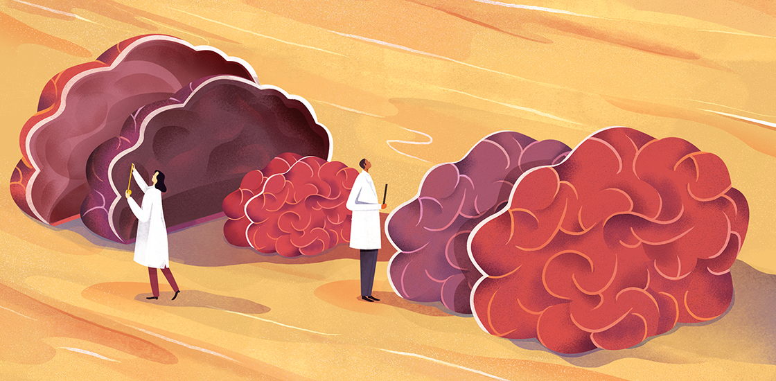 science research autism Brains Researchers editorial conceptual.jpg